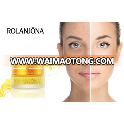 Rolanjona fade out face night cream and face whitening cream for women